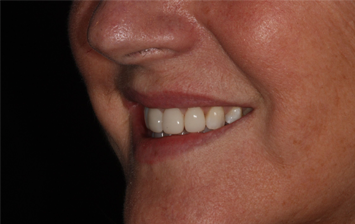 After - Hunts Cross Dental Centre