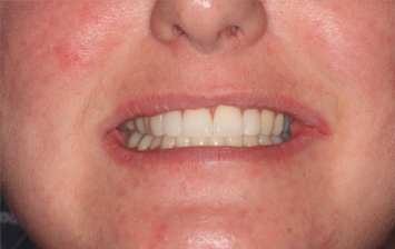 After - Hunts Cross Dental Centre